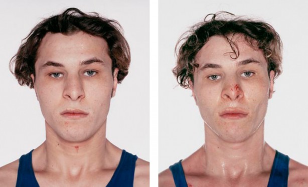 Foto - Dövüşçülerin maç sonu halleri