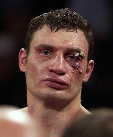 Foto - Dövüşçülerin maç sonu halleri