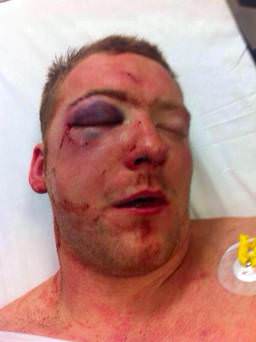 Foto - Dövüşçülerin maç sonu halleri