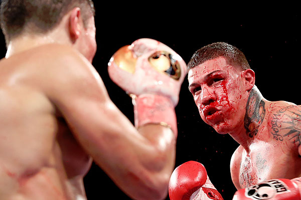 Foto - Dövüşçülerin maç sonu halleri