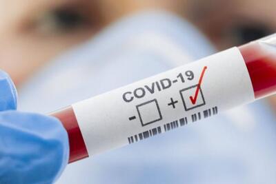 Foto - DSÖ'den 27 Aralık açıklaması! Ülkelere koronavirüs ile ilgili çok önemli çağrı