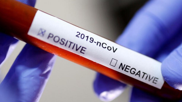 Foto - DSÖ'den 27 Aralık açıklaması! Ülkelere koronavirüs ile ilgili çok önemli çağrı