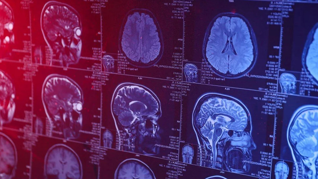 Foto - DSÖ'den şok uyarı: Hava kirliliği sağlığımızı tehdit ediyor