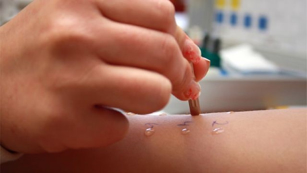 Foto - Dudak kenarlarındaki kaşıntıya dikkat!