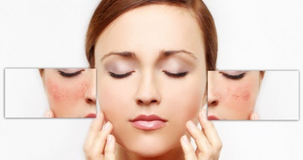 Foto - Dudak kenarlarındaki kaşıntıya dikkat!