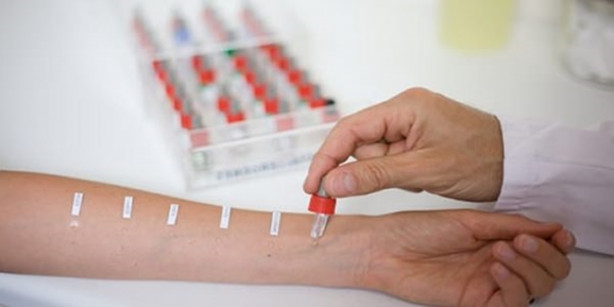 Foto - Dudak kenarlarındaki kaşıntıya dikkat!