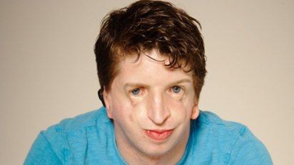 Foto - Dünya bu adamı konuşuyor