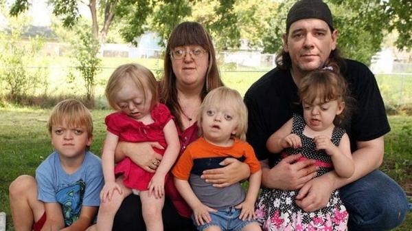 Foto - Dünya bu adamı konuşuyor