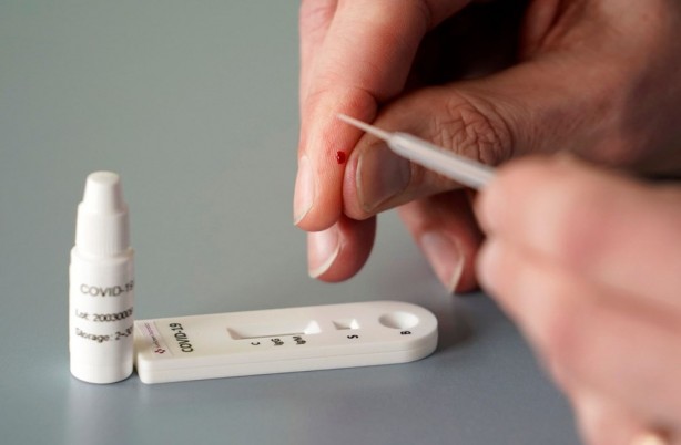 Foto - Dünya bu keşfi konuşuyor: Koronavirüsü 4 gün içerisinde vücuttan atıyor