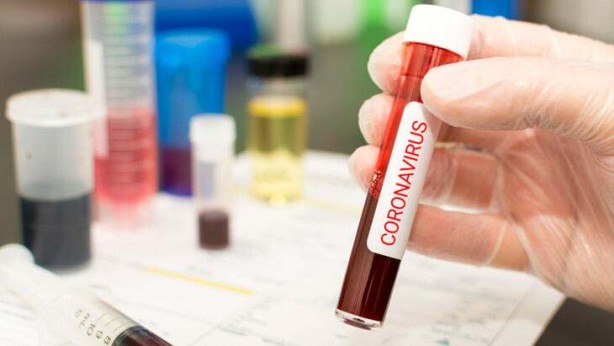 Foto - Dünya bu olayı konuşuyor! Beyaz Saray’a ait gizli belge basına sızdı