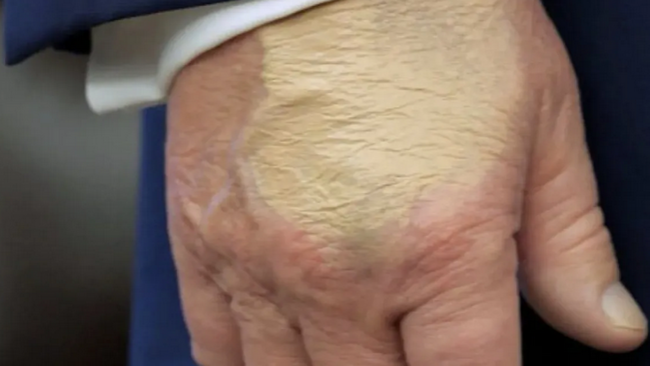 Foto - Dünya bunu konuşuyor: ABD’de Trump’ın sağlık durumu tartışılıyor: 5 gündür kameralar karşısına çıkmadı