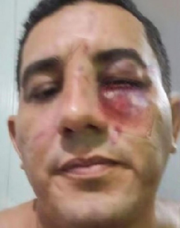 Foto - Dünya bunu konuşuyor! Biletler 100 dolar… Belediye Başkanlarını dövüştürdüler