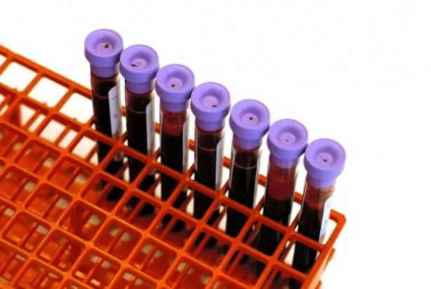 Foto - Dünya bunu yeni öğrendi! Bu kan grubuna sahipseniz dikkat