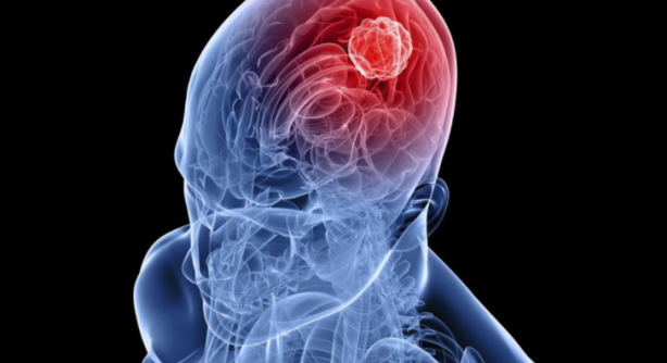 Foto - Dünya bunu yeni öğrendi! Bu kan grubuna sahipseniz dikkat