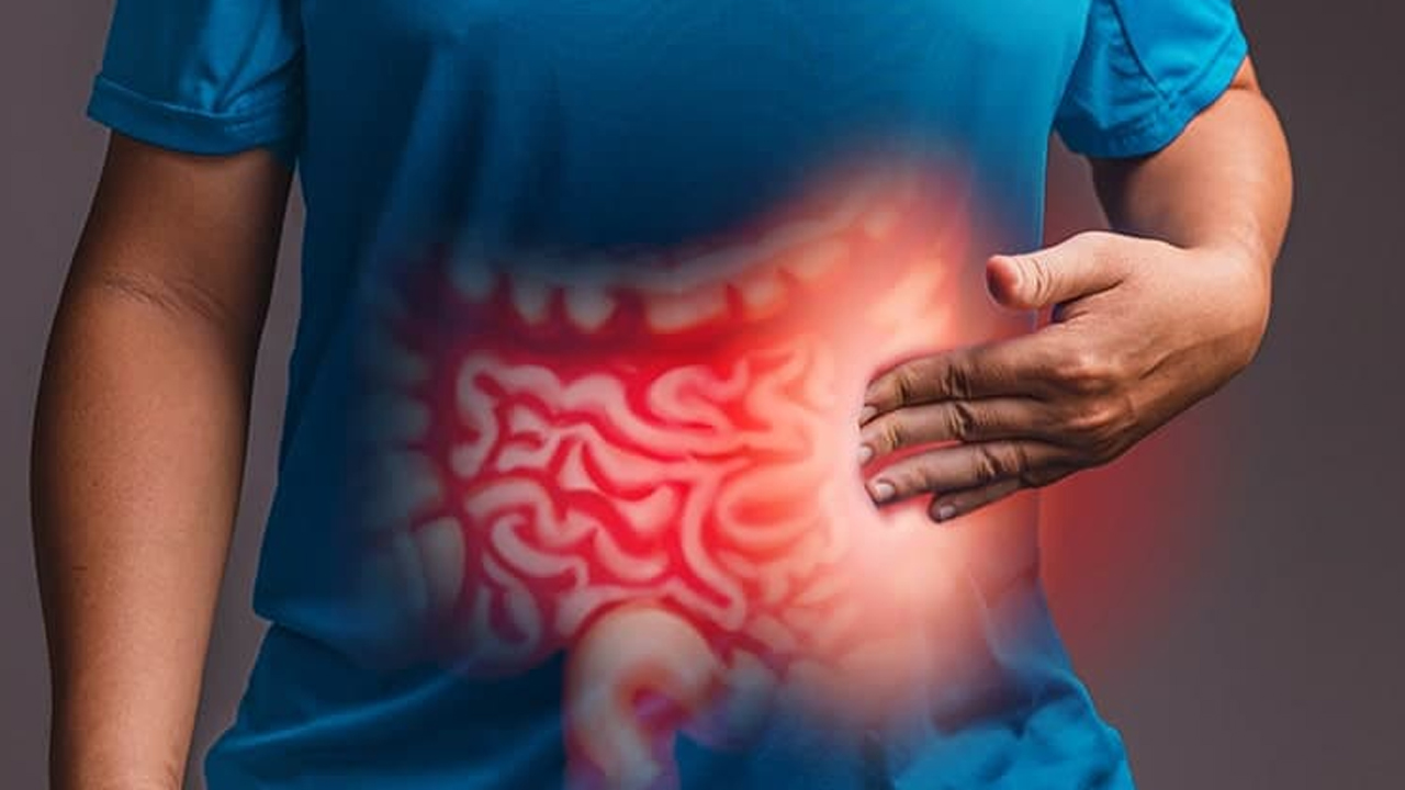 Dünya genelinde vakalar artıyor! Bağırsak kanserini önlemek için 5 sağlıklı yöntem