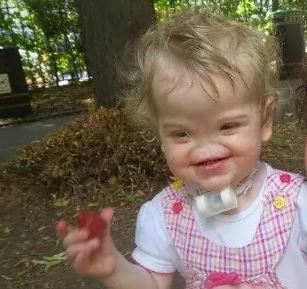 Foto - Dünya onu konuşuyordu! Burunsuz doğan bebek büyüdü: İşte son hali...