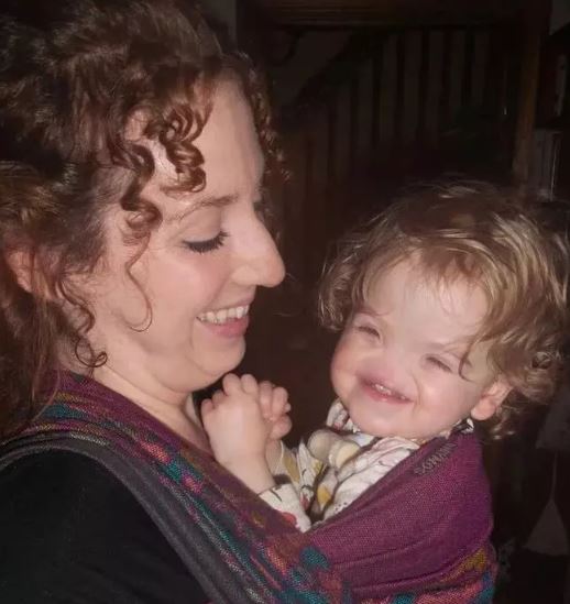 Foto - Dünya onu konuşuyordu! Burunsuz doğan bebek büyüdü: İşte son hali...