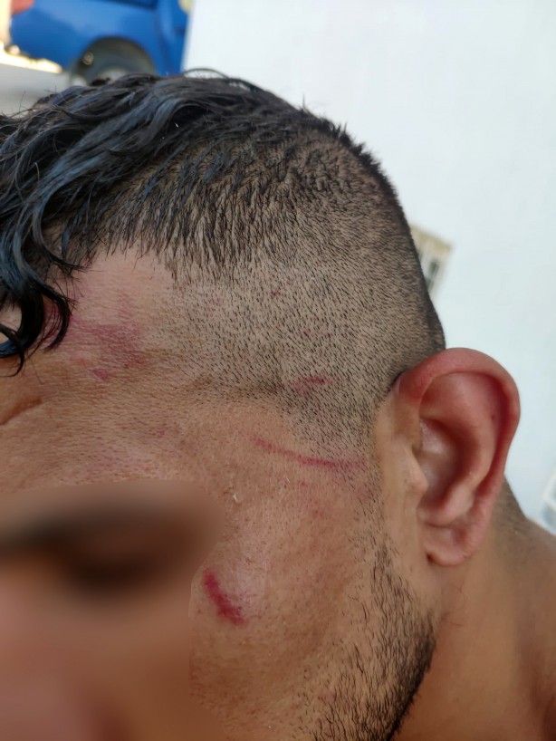 Foto - Dünya sadece seyrediyor! Yunanistan’ın suç karnesi kabarık çıktı