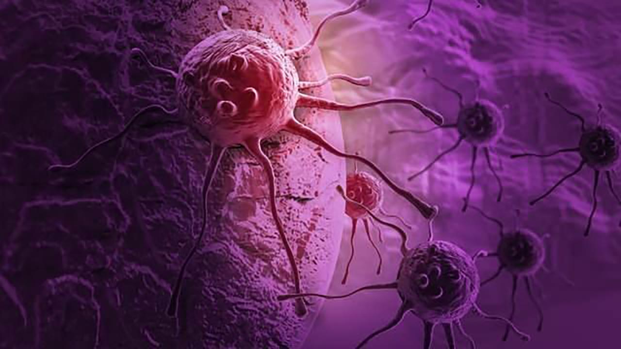 Dünya Sağlık Örgütü’nden dikkat çeken açıklama! Kanser riskini azaltan 23 yiyecek