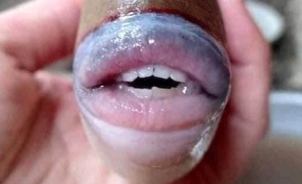 Dünya şokta! Bu halde bulundu