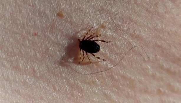 Foto - Dünyada bir ilk! Binlerce kişiyi öldüren hastalığa ilk aşı Türkiye'den