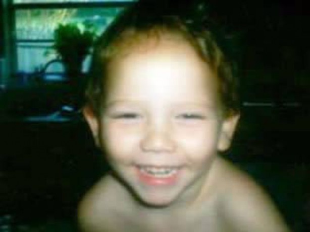 Foto - Dünyada eşi benzeri görülmemiş hayret verici hastalıklar!