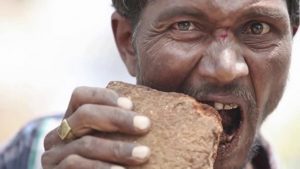 Foto - Dünyada görülen nadir ve garip 10 hastalık...