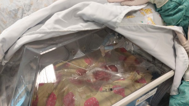 Foto - Dünyada nadir rastlanıyor! Türkiye'de 310 gramlık bebek doğdu