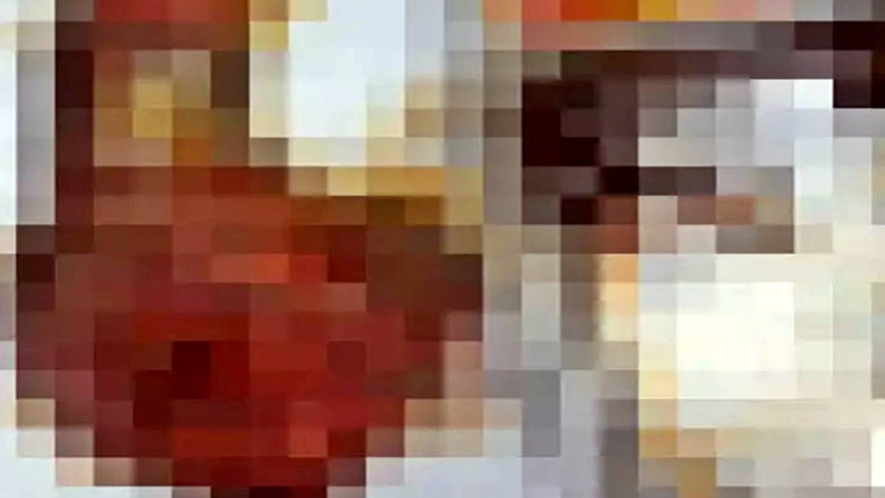 Foto - Dünyada örneği yok! Karın şişliğiyle gitti, karnından 90 santimetrelik kedi-köpek...