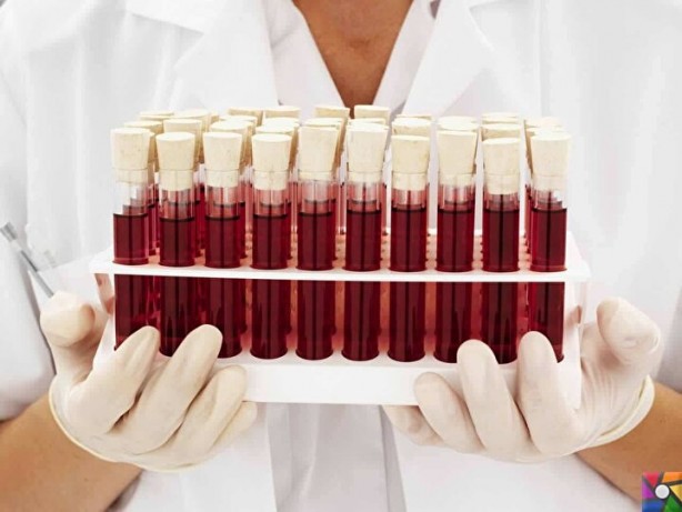 Foto - Dünyada sadece 43 kişide var! Gizemli kan grubundan haberiniz var mı?