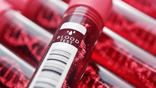 Foto - Dünyada sadece 43 kişide var! Gizemli kan grubundan haberiniz var mı?