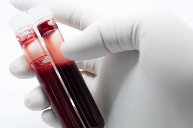 Foto - Dünyada sadece 43 kişide var! Gizemli kan grubundan haberiniz var mı?