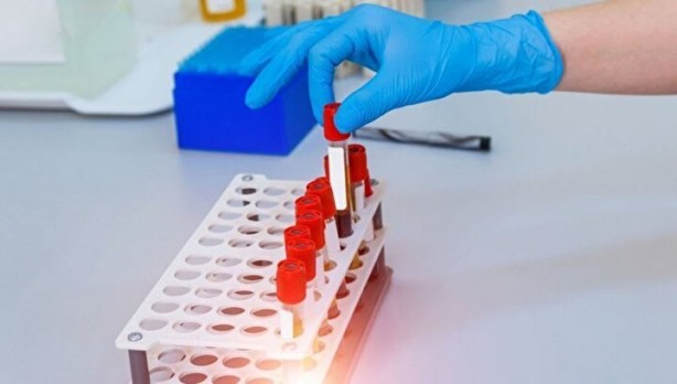 Foto - Dünyada sadece 43 kişide var! Gizemli kan grubundan haberiniz var mı?