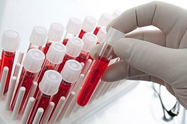 Foto - Dünyada sadece 43 kişide var! Gizemli kan grubundan haberiniz var mı?