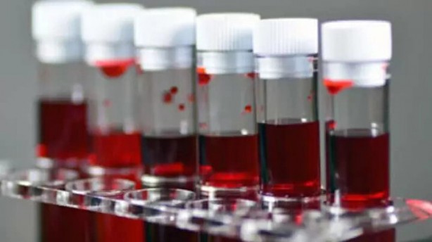 Dünyada sadece 43 kişide var! Gizemli kan grubundan haberiniz var mı?