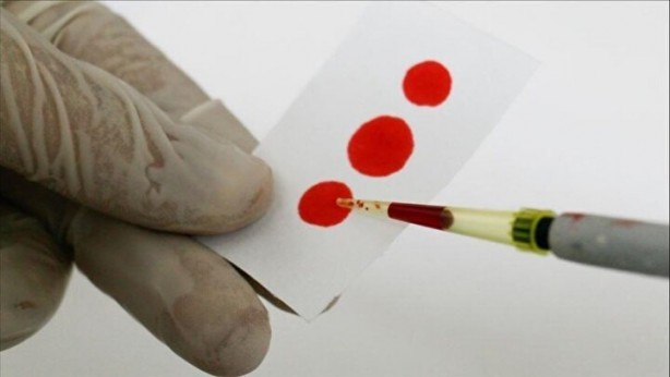 Foto - Dünyada sadece 43 kişide var! Gizemli kan grubundan haberiniz var mı?