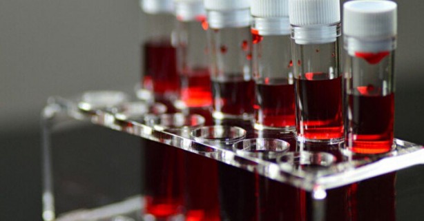 Foto - Dünyada sadece 43 kişide var! Gizemli kan grubundan haberiniz var mı?