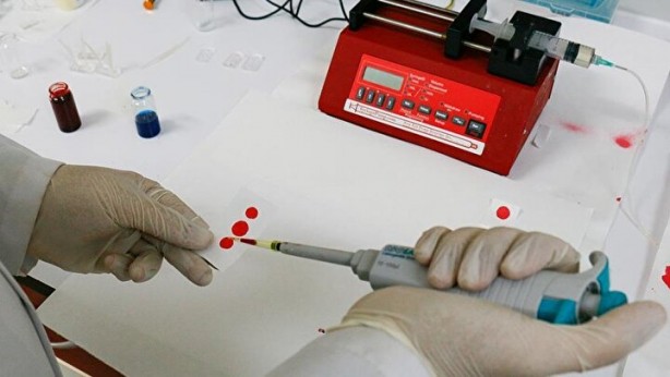 Foto - Dünyada sadece 43 kişide var! Gizemli kan grubundan haberiniz var mı?