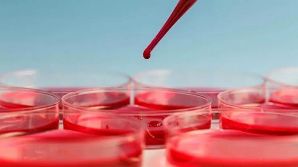 Foto - Dünyada sadece 43 kişide var! Gizemli kan grubundan haberiniz var mı?