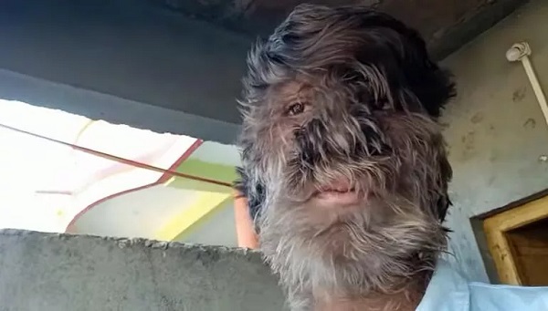 Foto - Dünyada sadece 50 kişide bu hastalık var! Kurt adamlar gerçek mi? 