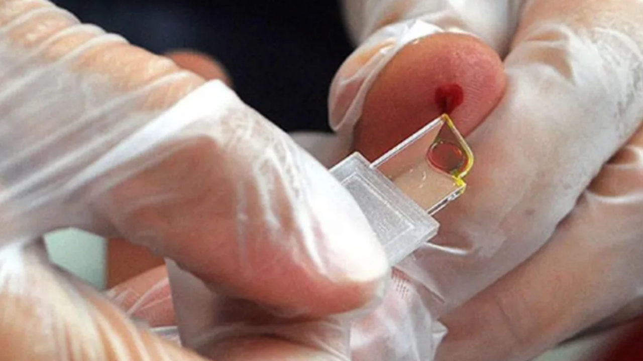 Dünyada sadece 50 kişide var: Yeni kan gurubu keşfedildi!