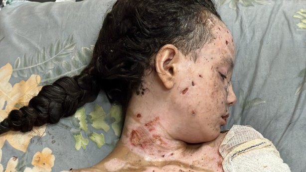 Foto - Dünyalar güzeli minik kız bu hale geldi