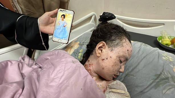 Foto - Dünyalar güzeli minik kız bu hale geldi