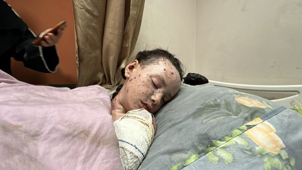 Foto - Dünyalar güzeli minik kız bu hale geldi