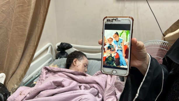 Foto - Dünyalar güzeli minik kız bu hale geldi