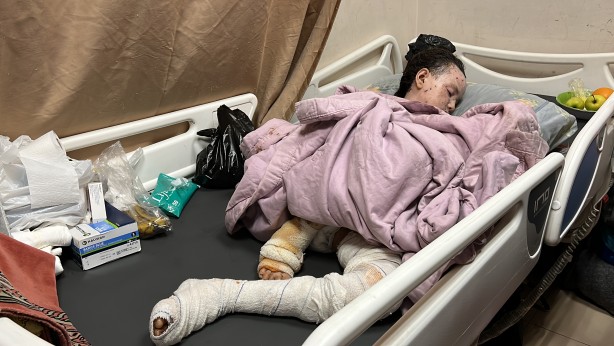 Foto - Dünyalar güzeli minik kız bu hale geldi