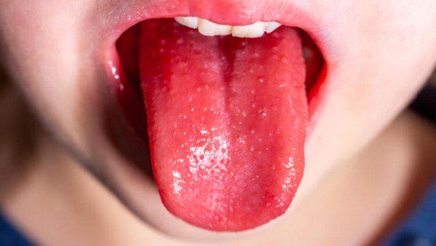 Foto - Dünyanın başındaki yeni bela! Kawasaki hastalığı nedir? Belirtileri nelerdir?