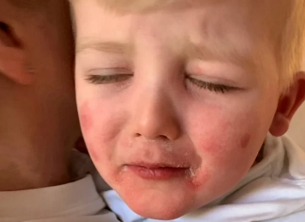 Dünyanın başındaki yeni bela! Kawasaki hastalığı nedir? Belirtileri nelerdir?