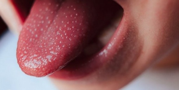 Foto - Dünyanın başındaki yeni bela! Kawasaki hastalığı nedir? Belirtileri nelerdir?