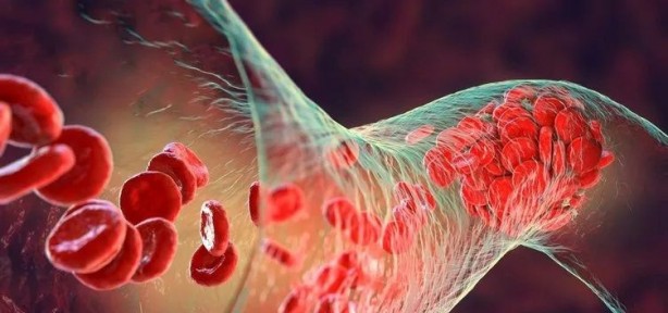 Foto - Dünyanın bir numarası seçildi! Yalnızca iki kaşık tüketmek yetiyor